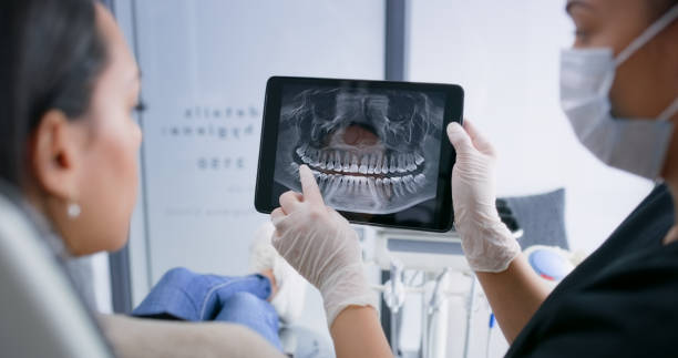 Licensed Tooth Extraction service in Rowan County County, NC - Smile Center Dentistry